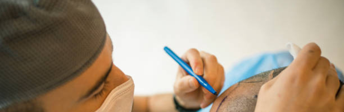 Hair Transplant in Riyadh Cover Image