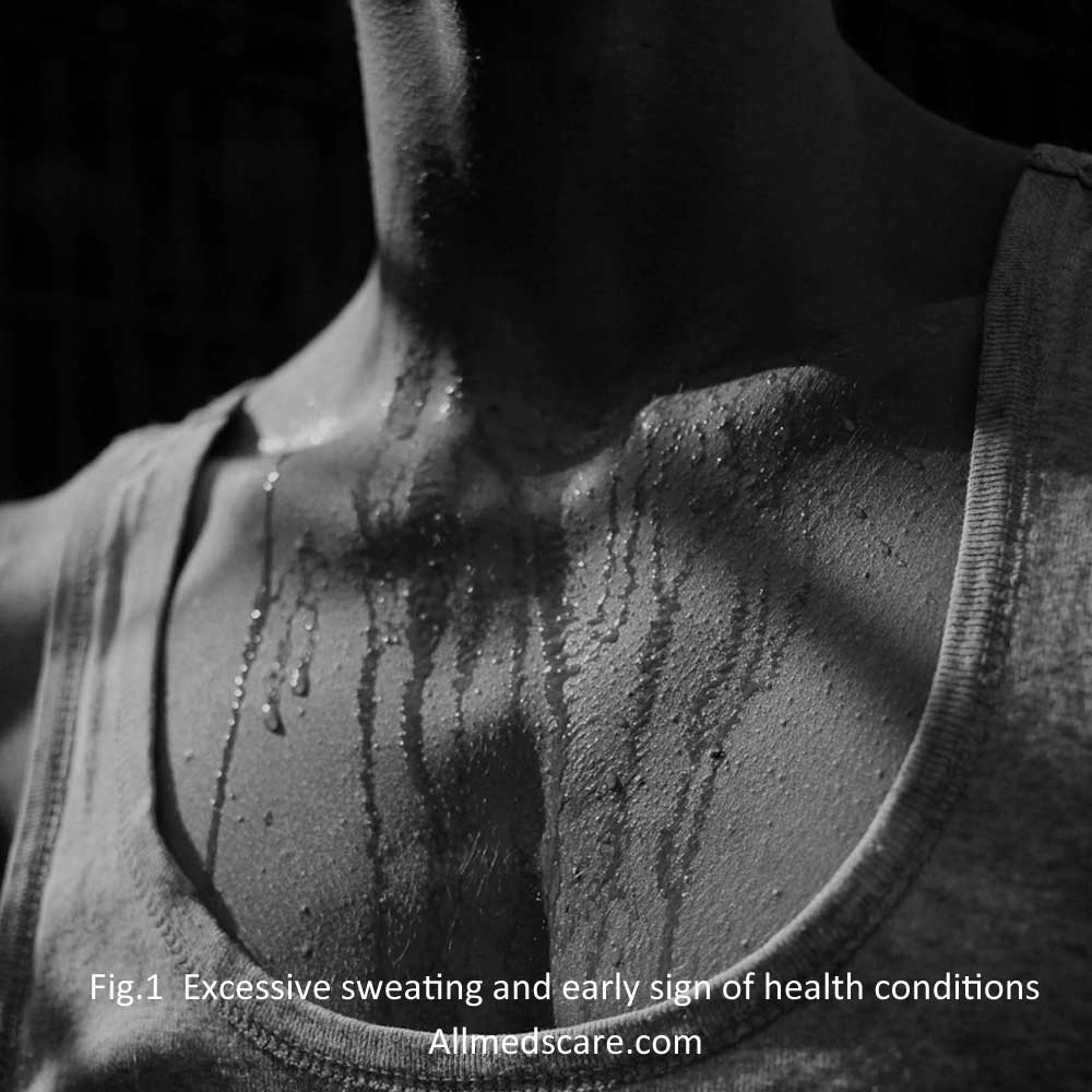 Hyperhidrosis: Excessive  Sweating  and Early Signs- Allmedscare