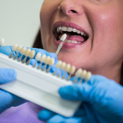 Best Dental Implants in Islamabad