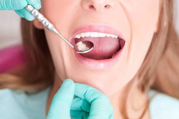 Top 10 Benefits of Visiting a Dentist Monroe Township Regularly | MABIAB