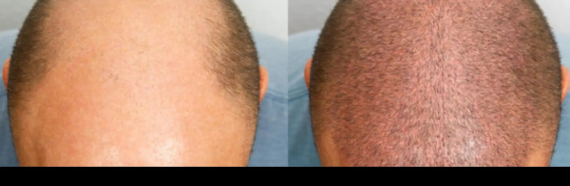 Myhair Line Cover Image