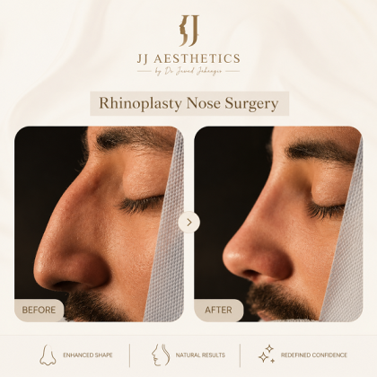 Rhinoplasty in Islamabad | Best Nose Reshaping Expert